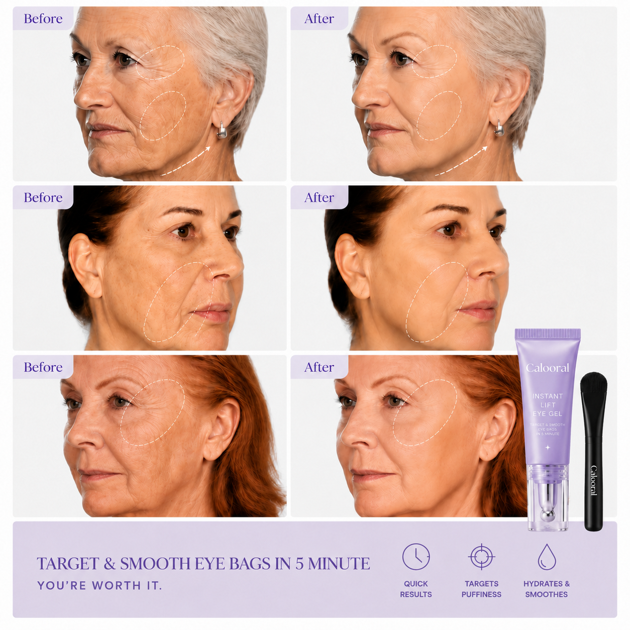 Calooral™ Eye Bag Instant Eraser, Tightens, Firms, & Blurs Wrinkles
