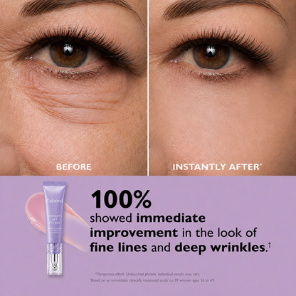 Calooral™ Eye Bag Instant Eraser, Tightens, Firms, & Blurs Wrinkles