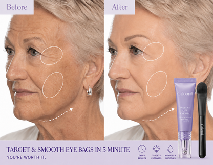 Calooral™ Eye Bag Instant Eraser, Tightens, Firms, & Blurs Wrinkles