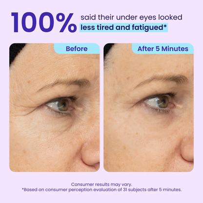 Calooral™ Eye Bag Instant Eraser, Tightens, Firms, & Blurs Wrinkles