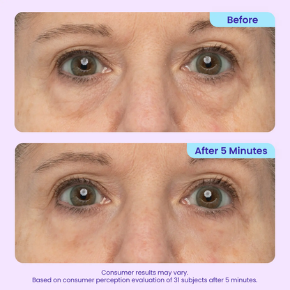 Calooral™ Eye Bag Instant Eraser, Tightens, Firms, & Blurs Wrinkles