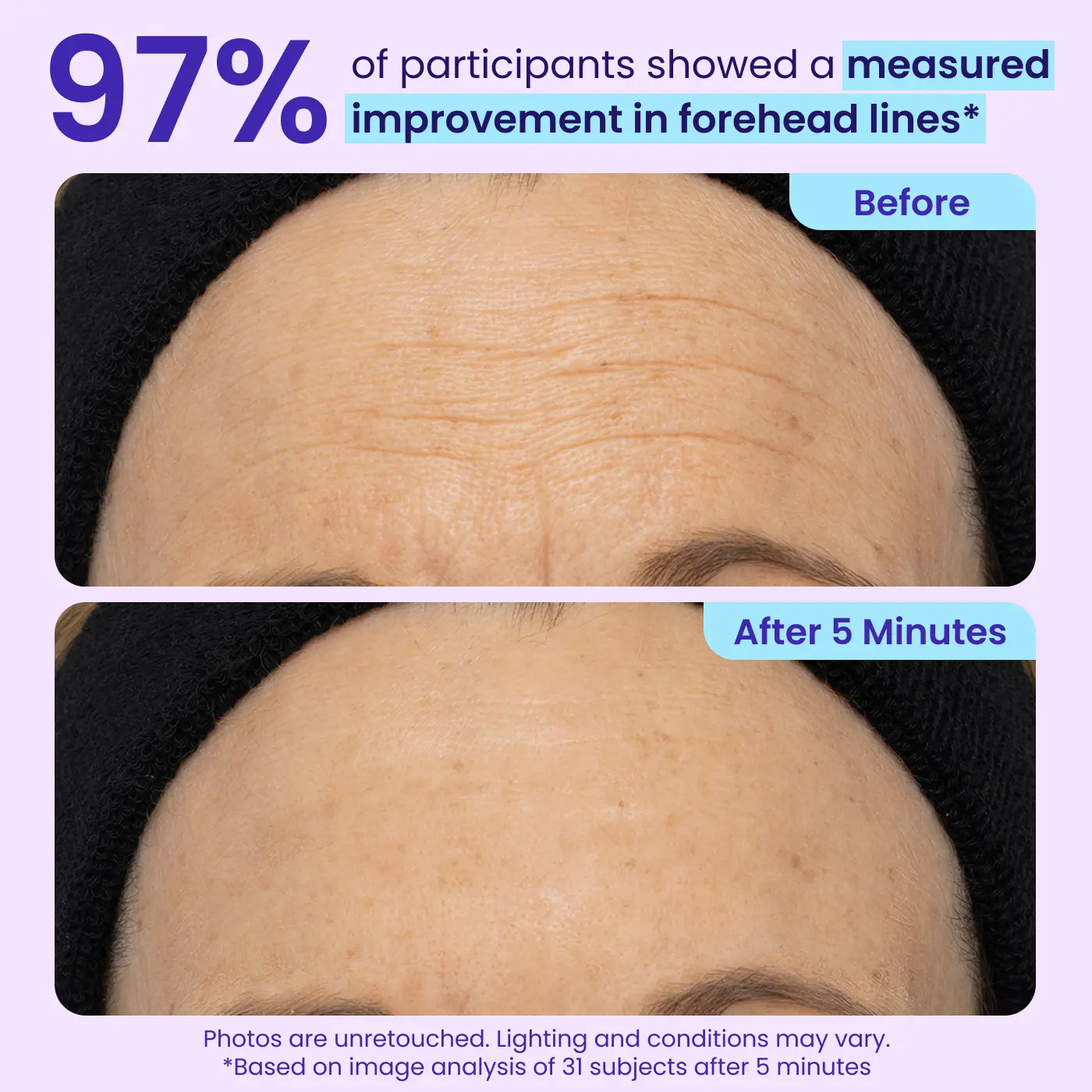Calooral™ Eye Bag Instant Eraser, Tightens, Firms, & Blurs Wrinkles